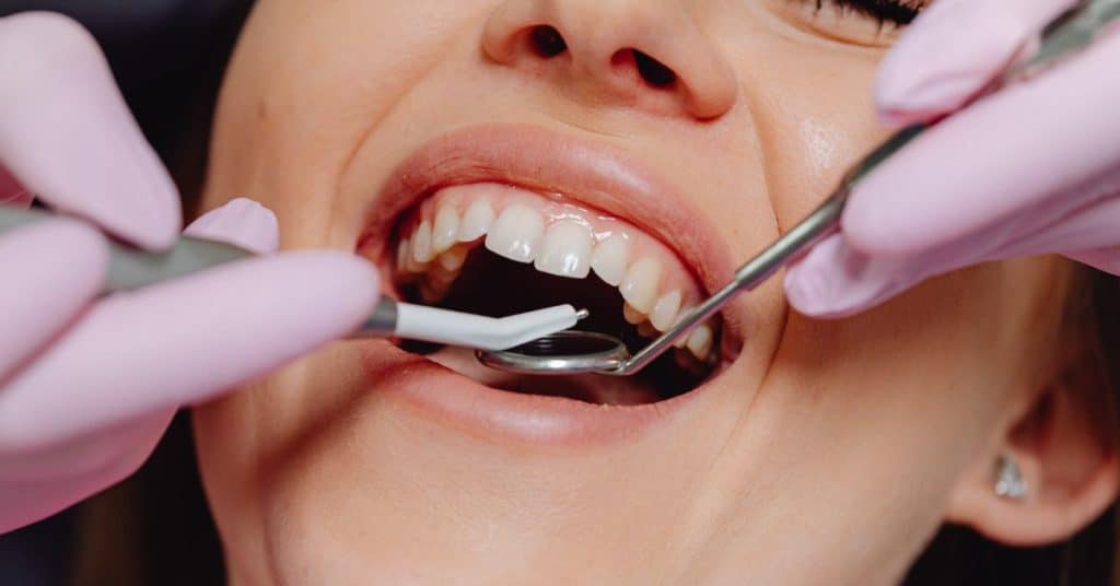 היתרון המקצועי של טיפול שיניים בטורקיה